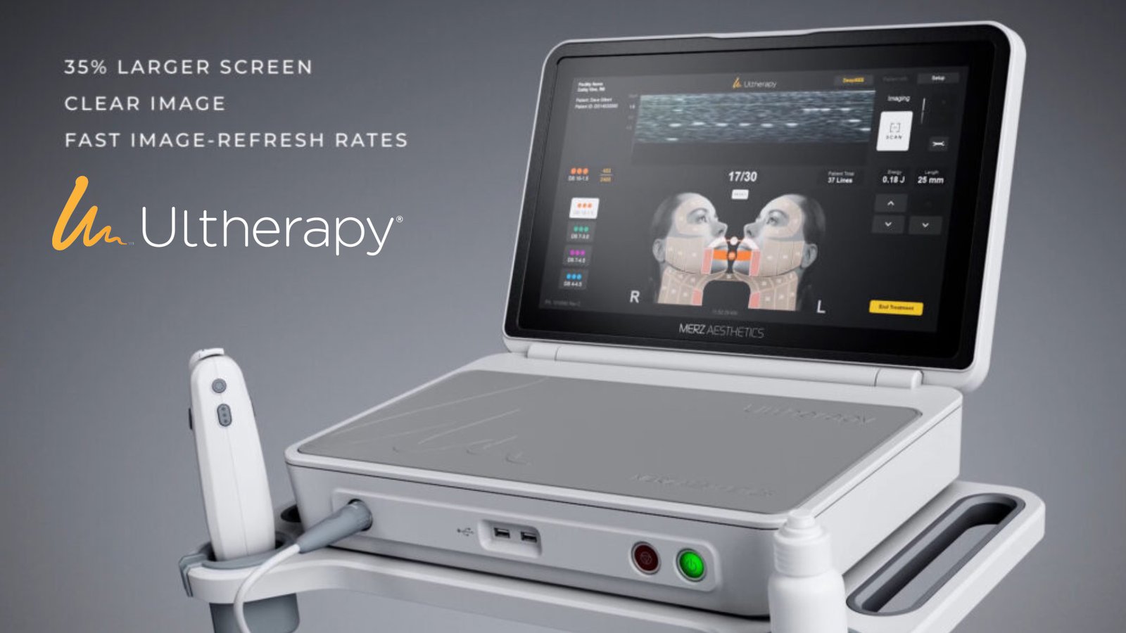 อัลเทอร่า_01