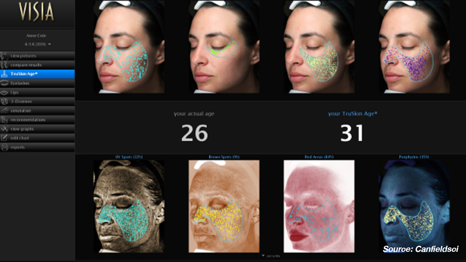 Skin Analysis_2