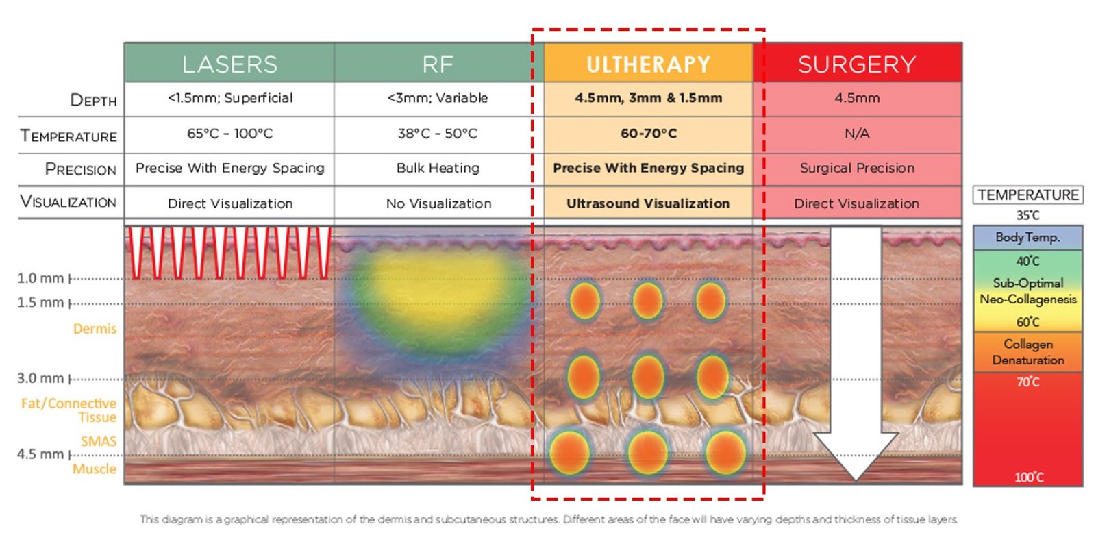 อัลเทอร่า_022
